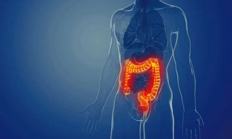 the best probiotics probion clinica probion daily probion active probion daily natural probiotics ibs digestion